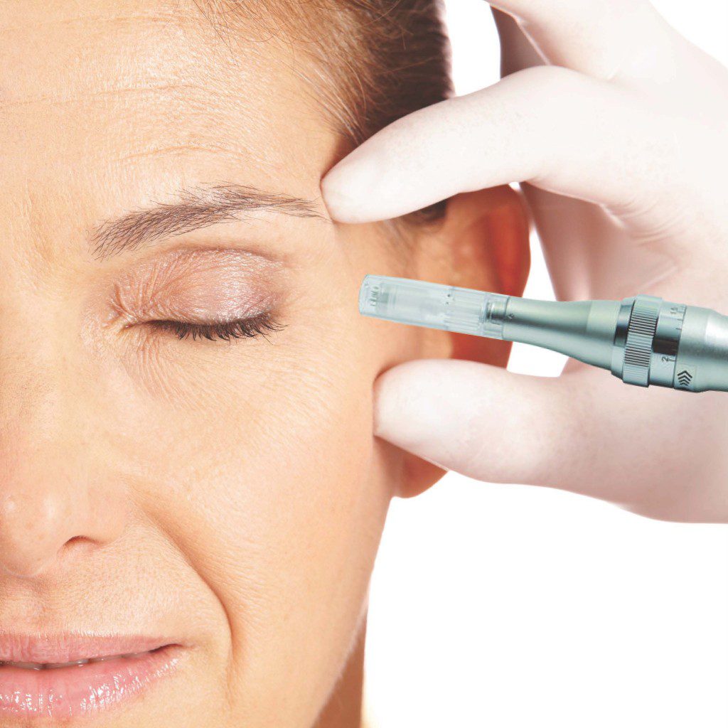 How Regenerative Microneedling Can Help Rejuvenate Skin?